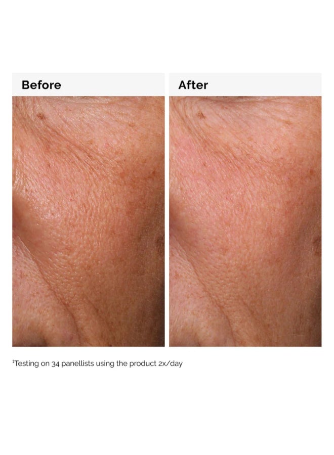 ذا اورديناري حمض الهيالورونيك 2% + ب5 - Image 5